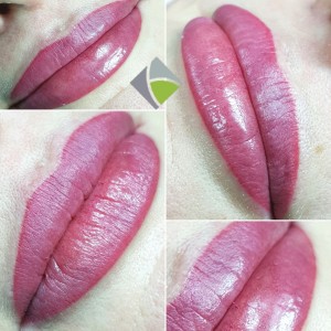 Lippenmodellierung_Berlin